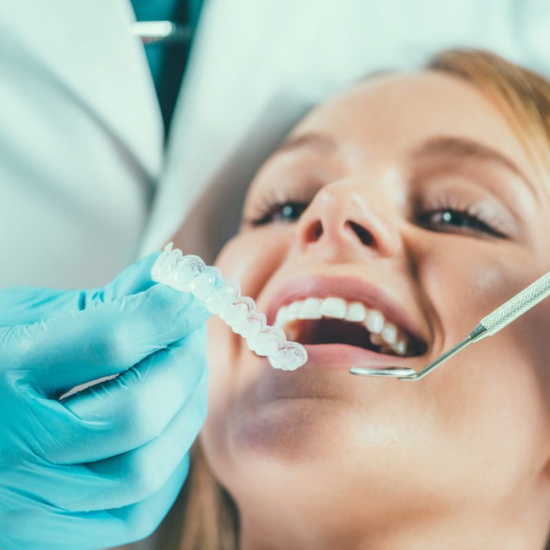 Teeth,Whitening,Procedure